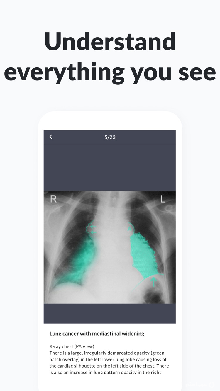 AMBOSS Medical Knowledge screenshot 6