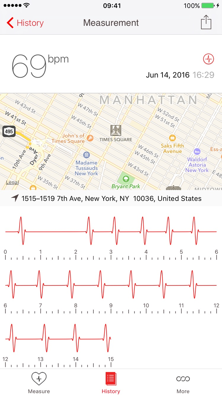Cardiograph screenshot 4