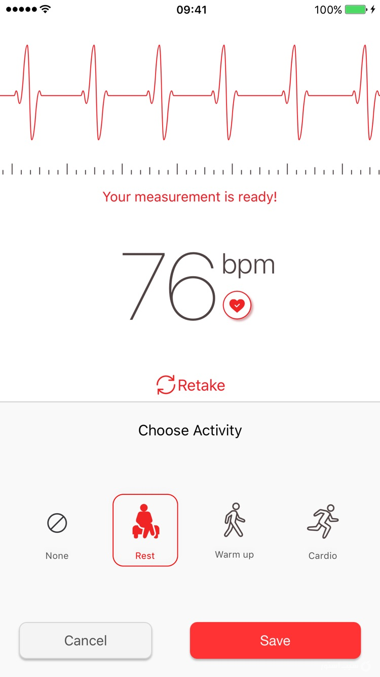 Cardiograph screenshot 2