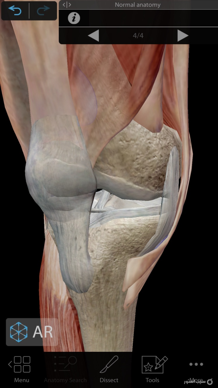 Muscles & Kinesiology screenshot 3